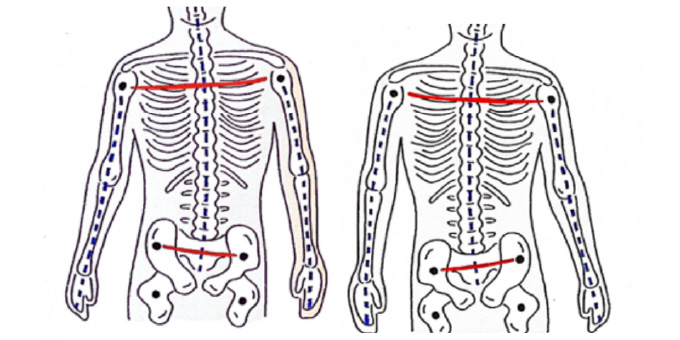 骨格チェックを受けてる人